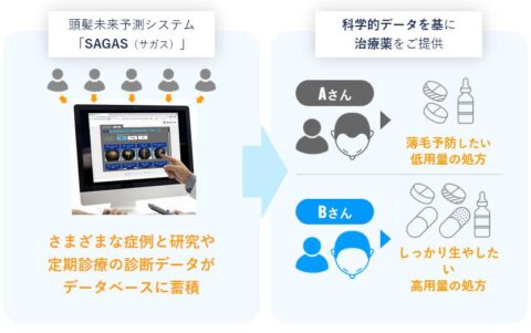 オーダーメイド発毛治療