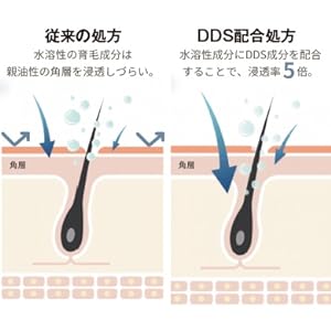 DDS ドラッグデリバリーシステム