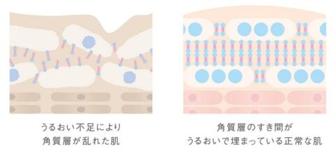 ラメラストレートリペア技術